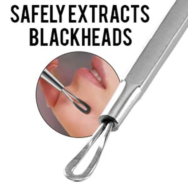 Surgimac Blackhead Remover Pimple Popper Tool, Acne Comedone Extractor, Blemish Whitehead Zit Removing Tool for Nose Face, Stainless Steel
