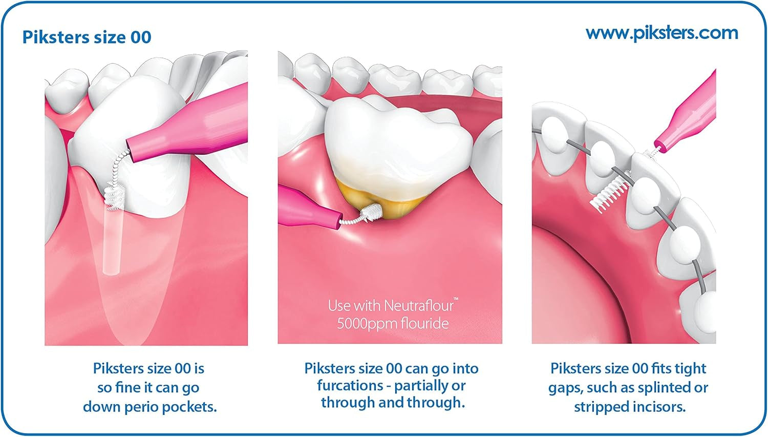 Piksters Interdental Brushes, 40 Pk, Size 00, Interdental Tooth Brush for Extremely Tight Gaps, Gum Soft Bristles for Plaque Removal, Safe for Braces