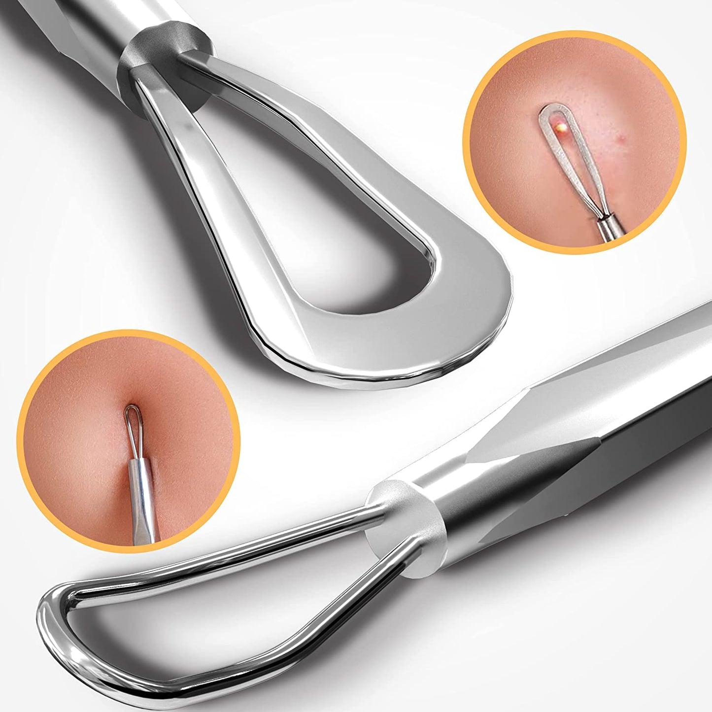 Surgimac Blackhead Remover Pimple Popper Tool, Acne Comedone Extractor, Blemish Whitehead Zit Removing Tool for Nose Face, Stainless Steel